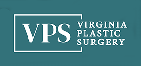 VPS